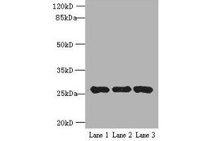 Western blot All lanes: EXOSC5 antibody at 5 μg/mL Lane 1: K562 whole cell lysate Lane 2: 293T whole cell lysate Lane 3: Hela whole cell lysate Secondary Goat polyclonal to rabbit IgG at 1/10000 dilution Predicted band size: 25 kDa Observed band size: 25 kDa (EXOSC5 抗体  (AA 1-235))