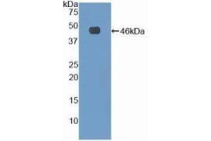 WB of Protein Standard: different control antibodies against Highly purified E. (Fibrillin 1 ELISA 试剂盒)