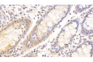 Immunohistochemistry (IHC) image for anti-Kininogen 1 (KNG1) (AA 390-644) antibody (ABIN7433357)