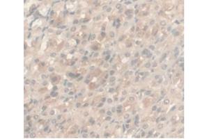IHC-P analysis of Rat Stomach Tissue, with DAB staining. (Androgen Receptor 抗体  (AA 491-679))
