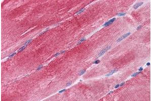 Human Skeletal Muscle: Formalin-Fixed, Paraffin-Embedded (FFPE) (BAG3 抗体  (AA 563-575))