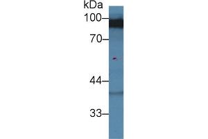 Western blot analysis of Rat Cerebrum lysate, using Human DLG3 Antibody (2 µg/ml) and HRP-conjugated Goat Anti-Rabbit antibody ( (MPP3 抗体  (AA 627-802))