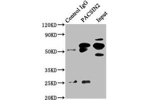 Immunoprecipitating PACSIN2 in HepG2 whole cell lysate Lane 1: Rabbit control IgG instead of ABIN7165686 in HepG2 whole cell lysate. (PACSIN2 抗体  (AA 240-410))