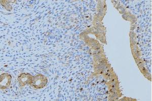ABIN6275893 at 1/100 staining Human uterus tissue by IHC-P. (CPA1 抗体  (Internal Region))