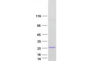 Western Blotting (WB) image for Claudin 19 (CLDN19) (Transcript Variant 1) protein (Myc-DYKDDDDK Tag) (ABIN2712853)