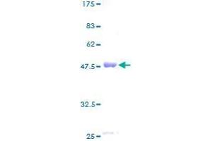 CBX3 Protein (AA 1-183) (GST tag)