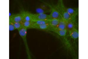 Confocal image of mixed rat neuron-glial cultures stained with our rabbit polyclonal antibody to ACIII (red) and our mouse monoclonal antibody to aII-spectrin (MCA-3D7 green).