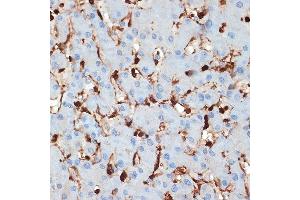 Immunohistochemistry of paraffin-embedded human liver using S100 Rabbit mAb (ABIN7270127) at dilution of 1:100 (40x lens). (S100A6 抗体)