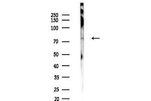 Western blot analysis of lysates from F10-LUC cells(heat-shock,45 min treatment), using CGB Antibody at 1/1000 dilution.