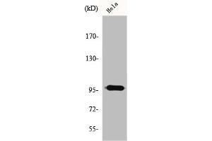 Western Blot analysis of HeLa cells using GAP1-InsP4 BP Polyclonal Antibody (RASA3 抗体  (Internal Region))