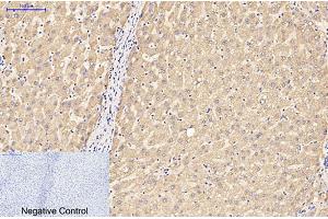 Immunohistochemical analysis of paraffin-embedded human liver tissue. (GFAP 抗体)