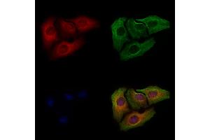 ABIN6255524 and ABIN6267296 staining Hela cells(4h of LPS treatment) by IF/ICC.