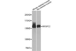 Western blot analysis of extracts of various cell lines, using MYBPC2 antibody. (MYBPC2 抗体)