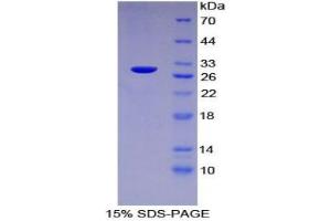 SDS-PAGE analysis of Human Lnk Protein. (SH2B3 蛋白)