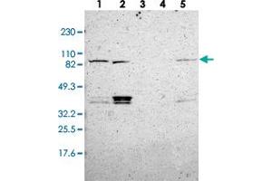 Western blot analysis of Lane 1: RT-4, Lane 2: U-251 MG, Lane 3: Human Plasma, Lane 4: Liver, Lane 5: Tonsil with MAD1L1 polyclonal antibody  at 1:250-1:500 dilution. (MAD1L1 抗体)