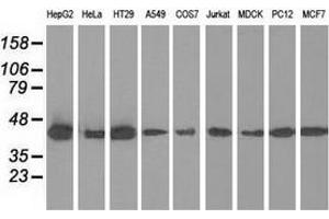 Western blot analysis of extracts (35 µg) from 9 different cell lines by using anti-IVD monoclonal antibody. (IVD 抗体)