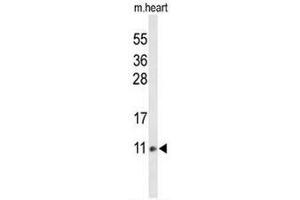 Western Blotting (WB) image for anti-Cytochrome C Oxidase Subunit VIa Polypeptide 2 (COX6A2) (AA 44-74), (Middle Region) antibody (ABIN951652)