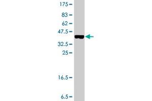 Western Blot detection against Immunogen (37 KDa) . (BLMH 抗体  (AA 356-454))