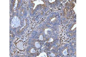IHC analysis of Hsp47/SERPINH1 using anti-Hsp47/SERPINH1 antibody (ABIN3043331). (SERPINH1 抗体  (AA 247-418))