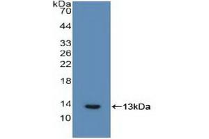 Detection of Recombinant IL6R, Human using Polyclonal Antibody to Interleukin 6 Receptor (IL6R)