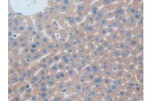 Immunohistochemistry (IHC) image for anti-C-Type Lectin Domain Family 10, Member A (CLEC10A) (AA 69-273) antibody (ABIN7441913)