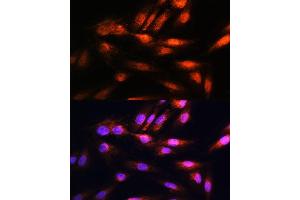 Immunofluorescence analysis of H9C2 cells using COPS8 Rabbit pAb (ABIN6130122, ABIN6138889, ABIN6138890 and ABIN6216486) at dilution of 1:100. (COPS8 抗体  (AA 1-209))