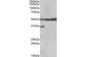 Western Blotting (WB) image for anti-Lymphocyte-Specific Protein 1 (LSP1) (C-Term) antibody (ABIN2464618) (LSP1 抗体  (C-Term))