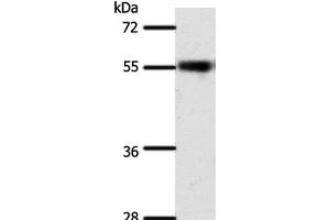 Western Blot analysis of Mouse eye tissue using SLC32A1 Polyclonal Antibody at dilution of 1:500 (SLC32A1 抗体)