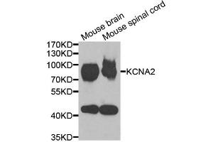 Western blot analysis of extracts of various cell lines, using KCNA2 antibody (ABIN5973718) at 1/1000 dilution. (KCNA2 抗体)