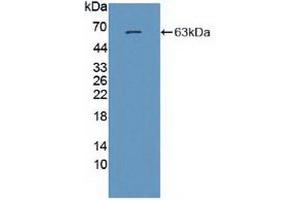 Western blot analysis of recombinant Human GRIN2A. (NMDAR2A 抗体  (AA 31-555))