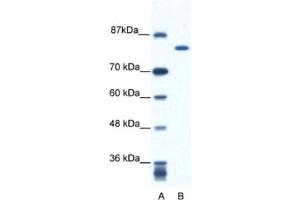 Western Blotting (WB) image for anti-Kinesin Family Member 23 (KIF23) antibody (ABIN2460845) (KIF23 抗体)