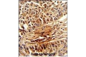 Immunohistochemistry (Paraffin-embedded Sections) (IHC (p)) image for anti-Peptidylprolyl Cis/trans Isomerase, NIMA-Interacting 1 (PIN1) (AA 30-56) antibody (ABIN652906)