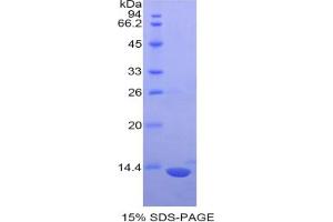 SDS-PAGE analysis of Mouse S100 Protein. (S100 Protein (S100) 蛋白)