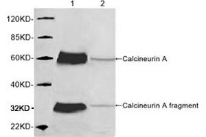 Western blot analysis of mouse brain tissue lysate using 1 µg/mL Rabbit Anti-Calcineurin A Polyclonal Antibody (ABIN398733) Lane 1: Rabbit Anti-Calcineurin A Polyclonal AntibodyLane 2: Rabbit Anti-Calcineurin A Polyclonal Antibody pre-incubated with immunizing peptideThe signal was developed with IRDyeTM 800 Conjugated Goat Anti-Rabbit IgG. (Calcineurin A 抗体  (AA 450-500))