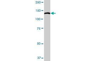 MYLK MaxPab rabbit polyclonal antibody. (MYLK 抗体  (AA 1-992))
