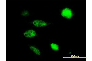 Immunofluorescence of purified MaxPab antibody to TUSC4 on HeLa cell. (NPRL2 抗体  (AA 1-380))