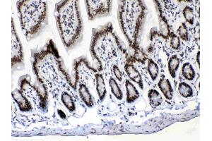 Immunohistochemistry (IHC) image for anti-Musashi Homolog 1 (Drosophila) (MSI1) (AA 21-54), (N-Term) antibody (ABIN5518855)