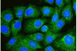 IF analysis of Beclin 1 using anti-Beclin 1 antibody (ABIN7599303).