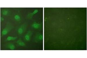 Immunofluorescence analysis of HeLa cells, using CSE1L Antibody. (Exportin 2 抗体  (AA 1-50))