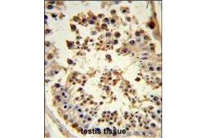 Immunohistochemistry (Paraffin-embedded Sections) (IHC (p)) image for anti-Heat Shock Protein 90kDa alpha (Cytosolic), Class B Member 1 (HSP90AB1) (AA 697-724), (C-Term) antibody (ABIN652406)