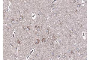 ABIN6268744 at 1/100 staining human brain tissue sections by IHC-P. (BMP6 抗体  (Internal Region))