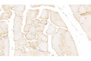 Detection of PADI2 in Human Skeletal muscle Tissue using Polyclonal Antibody to Peptidyl Arginine Deiminase Type II (PADI2) (PADI2 抗体)