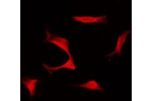 Immunofluorescence (fixed cells) (IF/ICC) image for anti-Aurora Kinase B (AURKB) (pThr232) antibody (ABIN6256516)