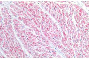 Immunohistochemistry of paraffin-embedded Human heart tissue using BST1 Polyclonal Antibody at dilution of 1:100. (BST1 抗体)