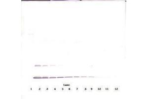 Image no. 3 for anti-Interleukin 2 (IL2) antibody (Biotin) (ABIN465290) (IL-2 抗体  (Biotin))