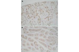 Immunohistochemistry (Formalin/PFA-fixed paraffin-embedded sections) of mouse kidney (A) and mouse epididymis (B) with Usp11 polyclonal antibody . (USP11 抗体)