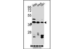 Western blot analysis in Jurkat,K562,U251 cell line lysates (35ug/lane). (HNRNPC 抗体  (C-Term))
