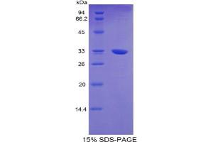 SDS-PAGE analysis of Mouse TNNT1 Protein. (TNNT1 蛋白)