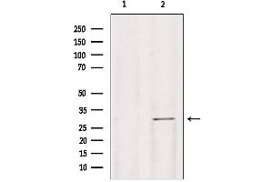 Western blot analysis of extracts from mouse lung, using Galc antibody. (GALC 抗体  (Internal Region))