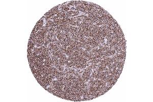 Immunohistochemistry (IHC) image for anti-Protein tyrosine Phosphatase, Receptor Type, C (PTPRC) antibody (ABIN7477413)